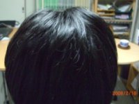 ケア開始後